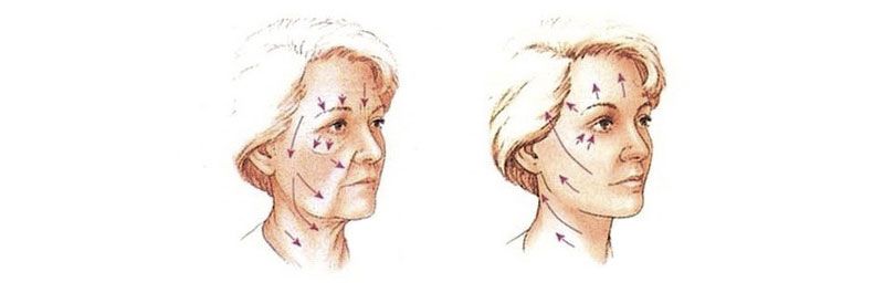 blog by-cosmetics botox